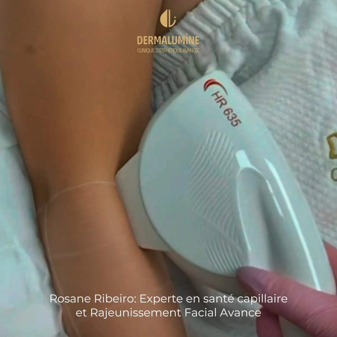 Séance d’épilation DPC chez DERMALUMINE